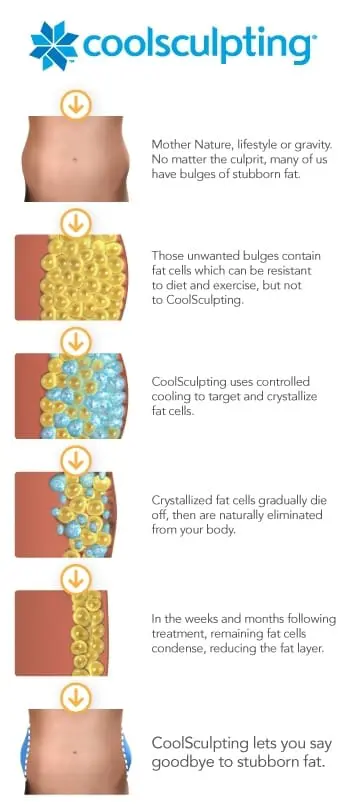 Coolsculpting® in San Diego, CA
