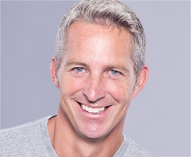 Blepharoplasty in San Diego, CA