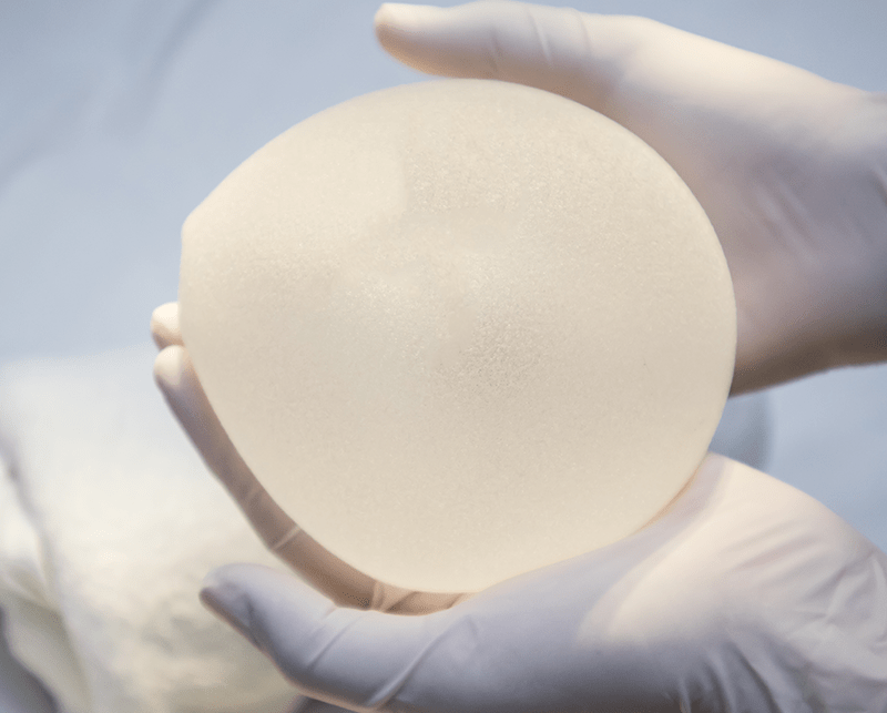 Breast Implant Removal San Diego, CA