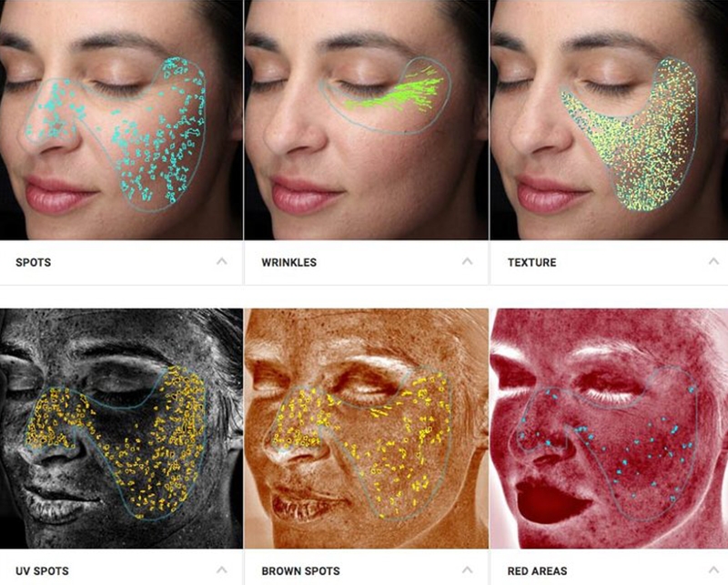 VISIA® Skin Analysis in San Diego, CA