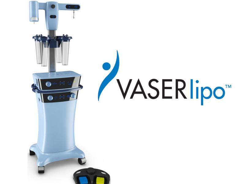 VASER Liposuction