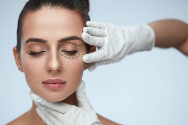 Blepharoplasty in San Diego, CA